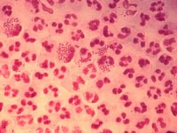 Young people urged to have sex safely as STI rates rocket 