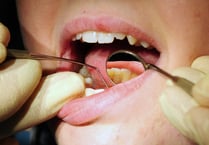 Dozens of admissions for tooth extractions on children in Cornwall
