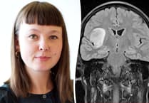Artist from Clay Country documents her brain tumour health journey